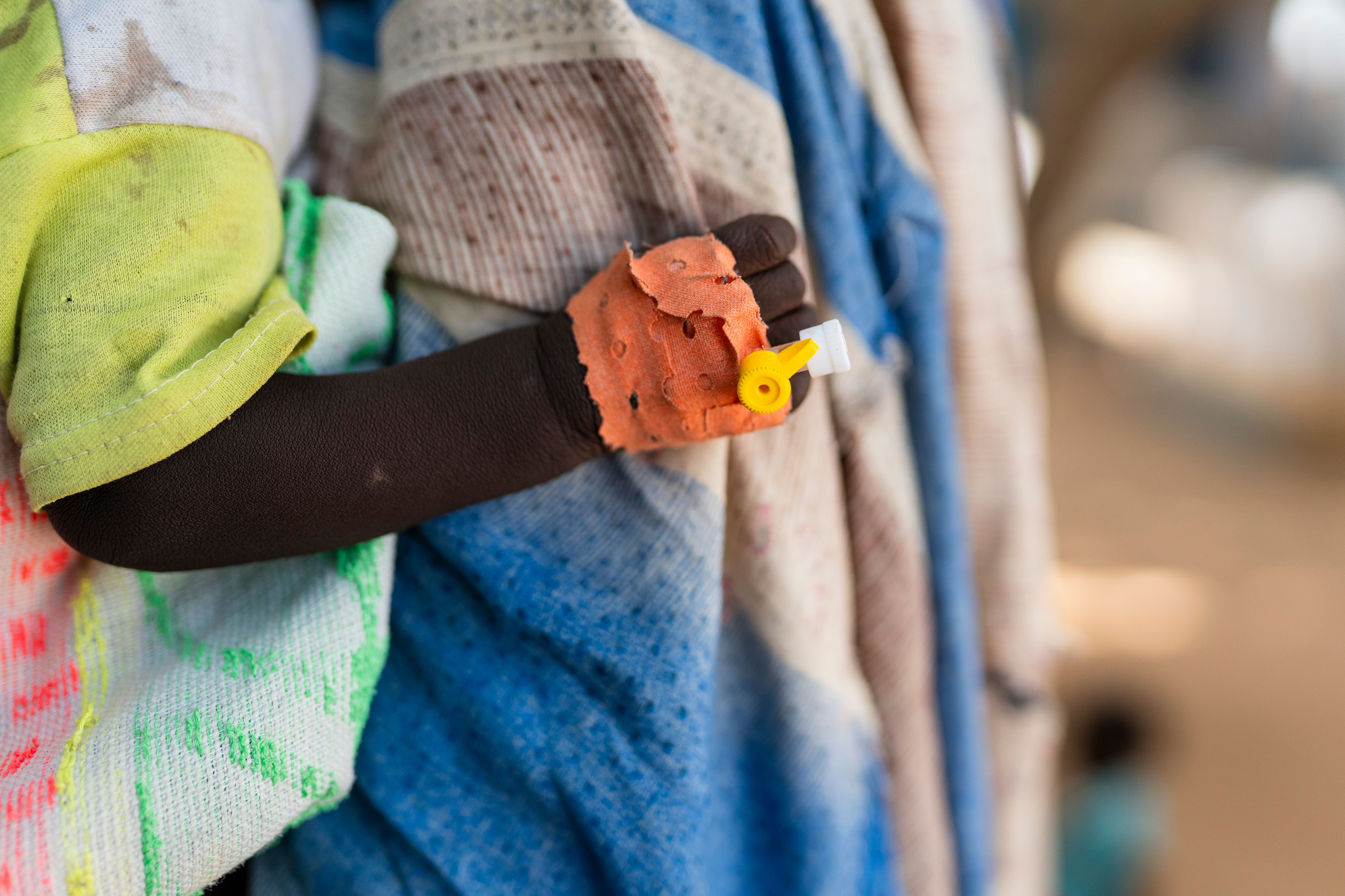 The malnutrition clinic at Farchana Hospital provides specialised meals and nutritional formulas to infants and children. But without urgent funding, the clinic will be forced to close its doors in late 2025.